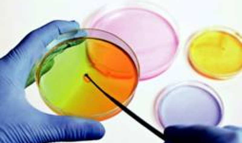 les-arees-de-microbiologia-i-bioquimica-de-l2019-lrc-acreditades-segons-la-norma-iso-15189-1.jpg